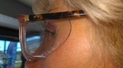 lunettes à chambre humide sur mesure pour le syndrome doeil sec